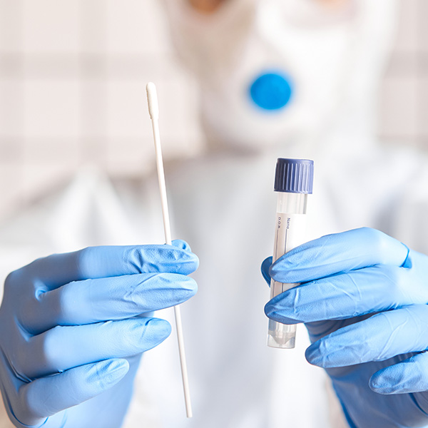 DETECCIÓN DE ARBOVIRUS POR PCR