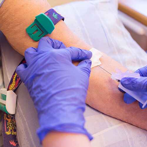HIDROXI-ESTEROIDES 17 SUERO HIDROXI-ESTEROIDES 17 SUERO