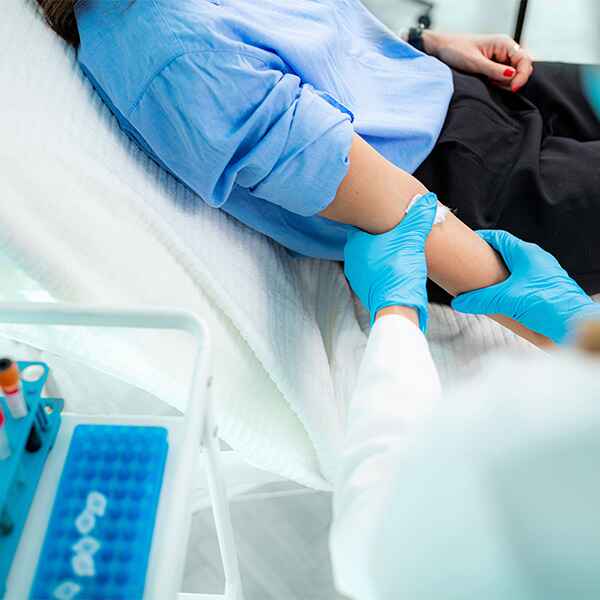 UREA EN SANGRE