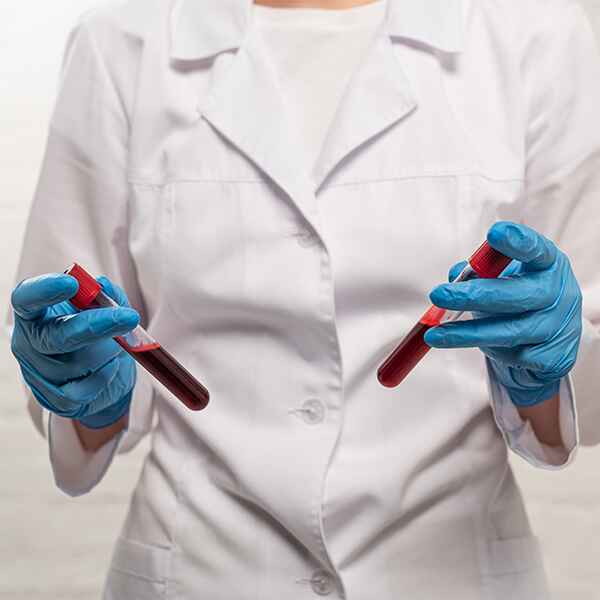 ANGIOTENSINA 1 ENZIMA CONVERTIDORA ANGIOTENSINA 1 ENZIMA CONVERTIDORA