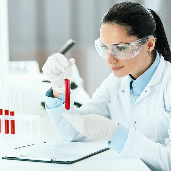 AC. ANTI COCCIDIOIDES IgG EN SUERO
