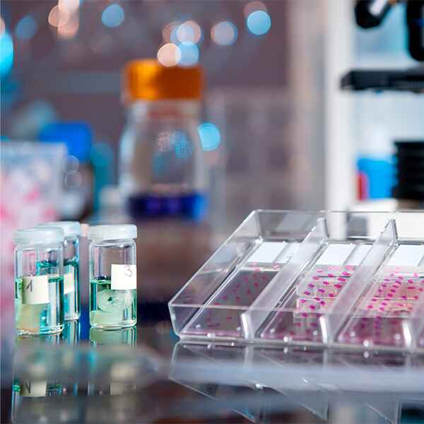 INMUNOHISTOQUÍMICA DE UN MARCADOR INMUNOHISTOQUÍMICA DE UN MARCADOR
