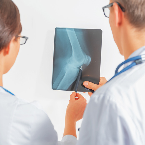 RX RODILLA AP Y LATERAL