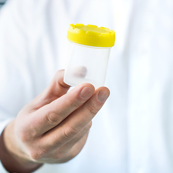 ADENOVIRUS EN MATERIA FECAL