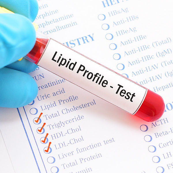 LIPOPROTEÍNAS DE ALTA DENSIDAD