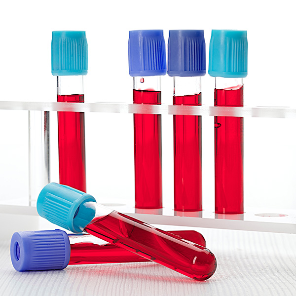 AC. ANTI TOXOPLASMA IGM (CUALITATIVO) AC. ANTI TOXOPLASMA IGM (CUALITATIVO)