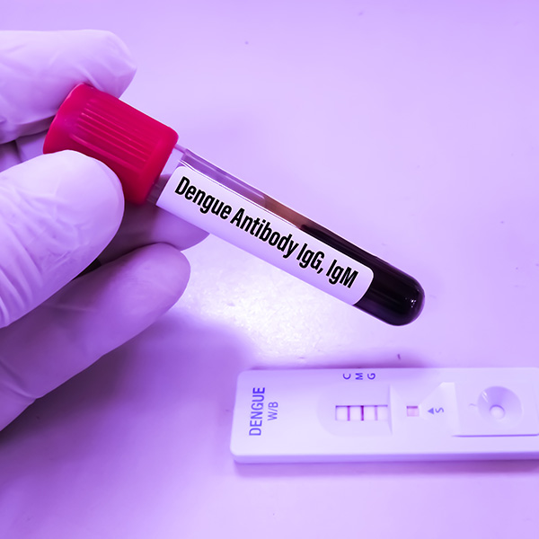 AC. ANTI-DENGUE IgG e IgM + ANTÍGENO NS1