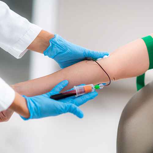 ELECTROFORESIS DE PROTEÍNAS