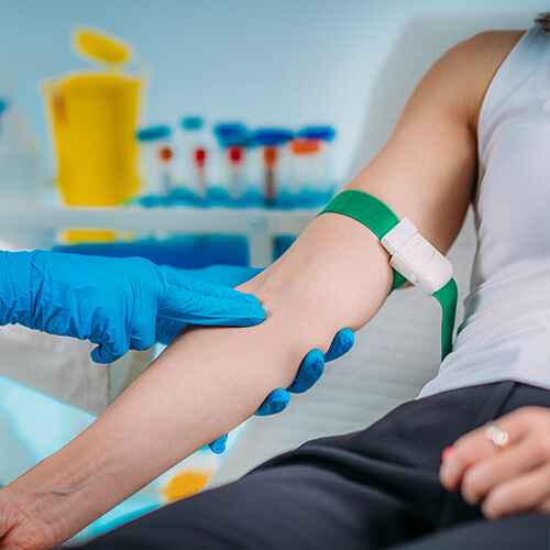 FOSFATASA ALCALINA