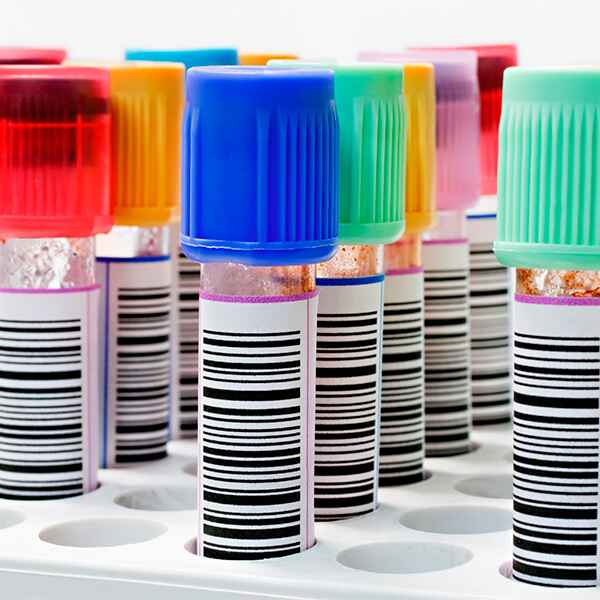 HERPESVIRUS 8 (HHV-8) DNA,PCR