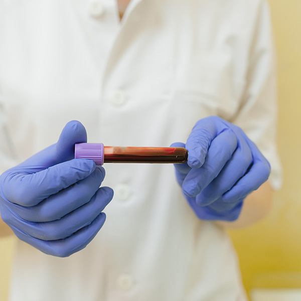 FACTOR REUMATOIDE CUANTITATIVO FACTOR REUMATOIDE CUANTITATIVO