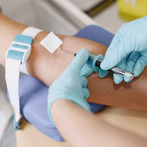 AC. ANTI COXIELLA BURNETTI IgG e IgM (FIEBRE Q)