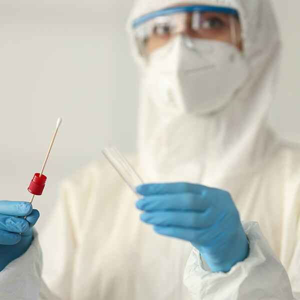 MYCOPLASMA PNEUMONIAE, DNA PCR MYCOPLASMA PNEUMONIAE, DNA PCR