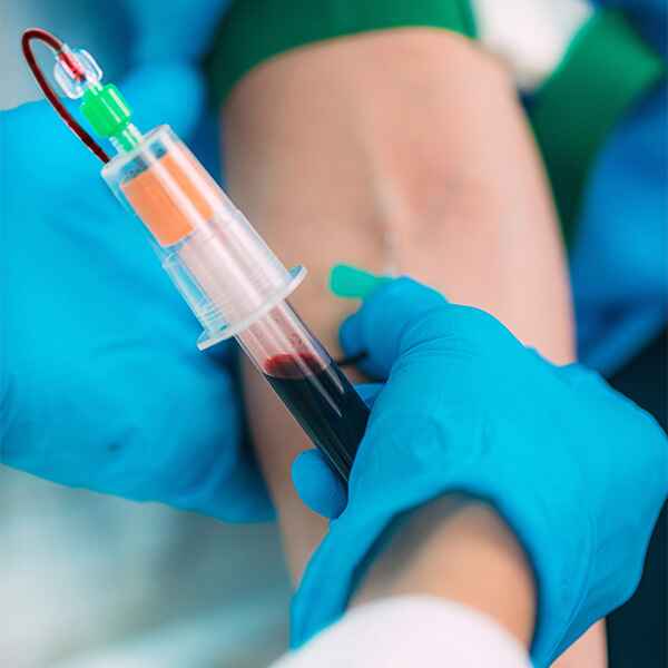 PERFIL ALERGIA ALIMENTICIA