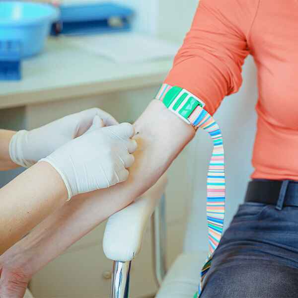 ANTICUERPOS ANTIESTREPTOLISINAS