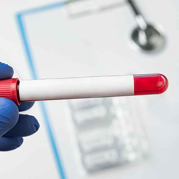 PROTEÍNA C ANTIGENICA