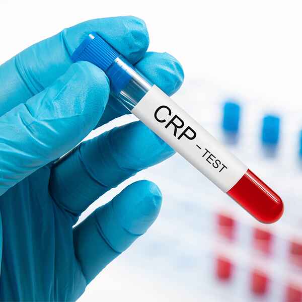PROTEÍNA C REACTIVA CUANTITATIVA PROTEÍNA C REACTIVA CUANTITATIVA
