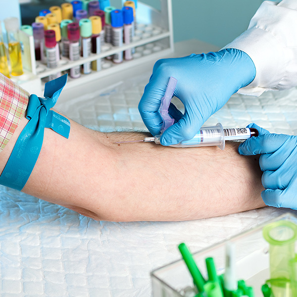 AC. ANTI-DNA DOBLE CADENA EN SUERO