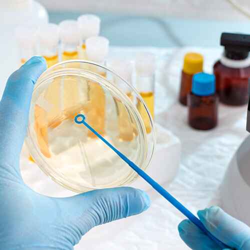 CULTIVO LÍQUIDO BIOLÓGICO