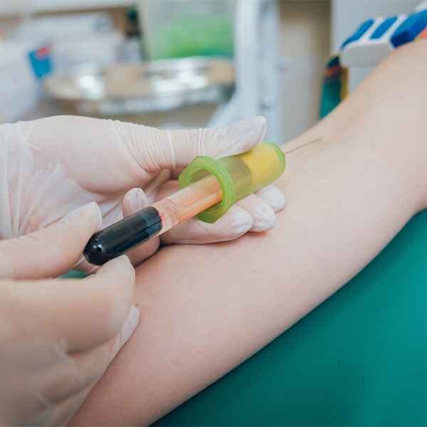 PARVOVIRUS B19 IGM