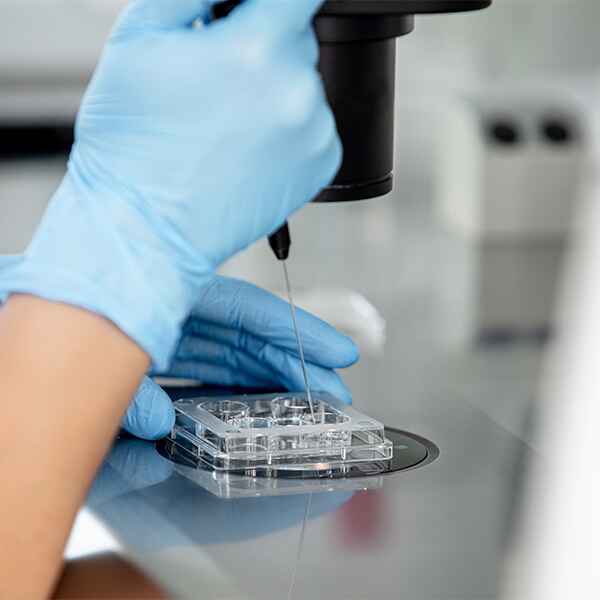BIOPSIA DE HÍGADO (MUESTRA RECIBIDA)