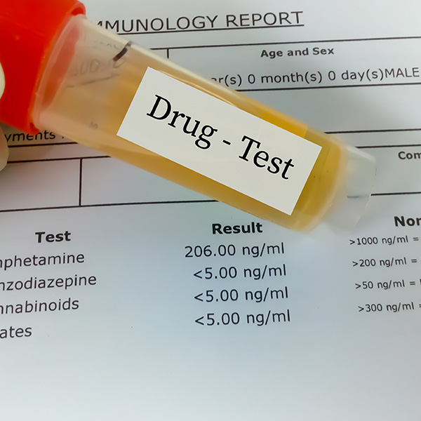 PERFIL DROGAS DE ABUSO 6 (THC, MET,AMP, BAR, BZD, COC) EN ORINA PERFIL DROGAS DE ABUSO 6 (THC, MET,AMP, BAR, BZD, COC) EN ORINA