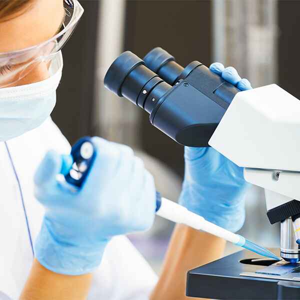AC. ANTI RIBONÚCLEOPROTEÍNAS (RNP) AC. ANTI RIBONÚCLEOPROTEÍNAS (RNP)