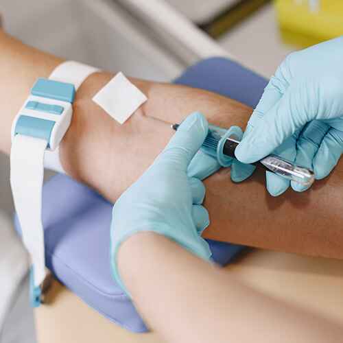 PRUEBA INMUNOLÓGICA DE EMBARAZO EN SUERO PRUEBA INMUNOLÓGICA DE EMBARAZO EN SUERO