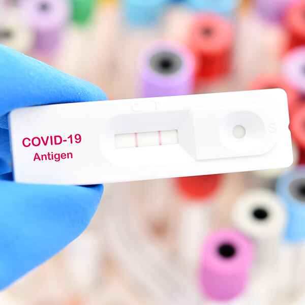 ANTÍGENO COVID (ABBOTT PANBIO COVID-19 AG)