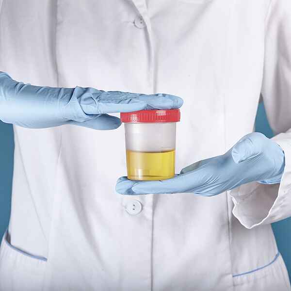 PROTEÍNA DE BENCE JONES