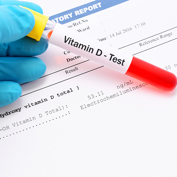 VITAMINA D, 25-HIDROXI (CALCIFEROL, D3)