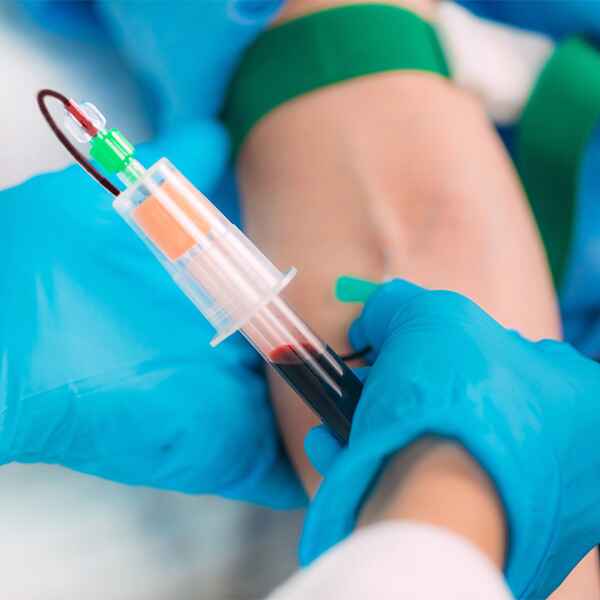 PROTEÍNA C REACTIVA NEFELOMETRICA PROTEÍNA C REACTIVA NEFELOMETRICA