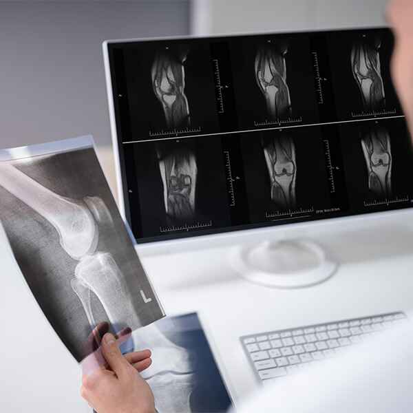 RX RODILLA AP Y LATERAL RX RODILLA AP Y LATERAL