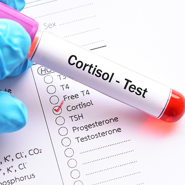 CORTISOL (SUERO) CORTISOL (SUERO)