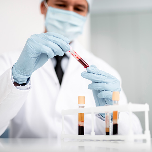 HEMOGLOBINA GLUCOSILADA A1C HEMOGLOBINA GLUCOSILADA A1C