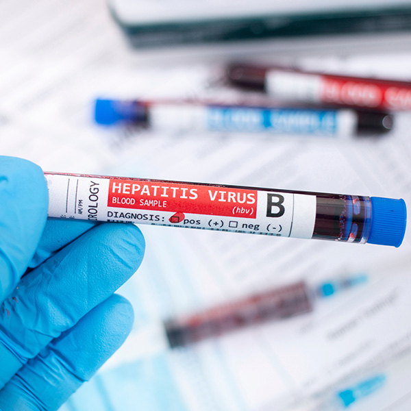 AC. ANTI-HEPATITIS B CORE  IgM (Anti- HBc IgM)
