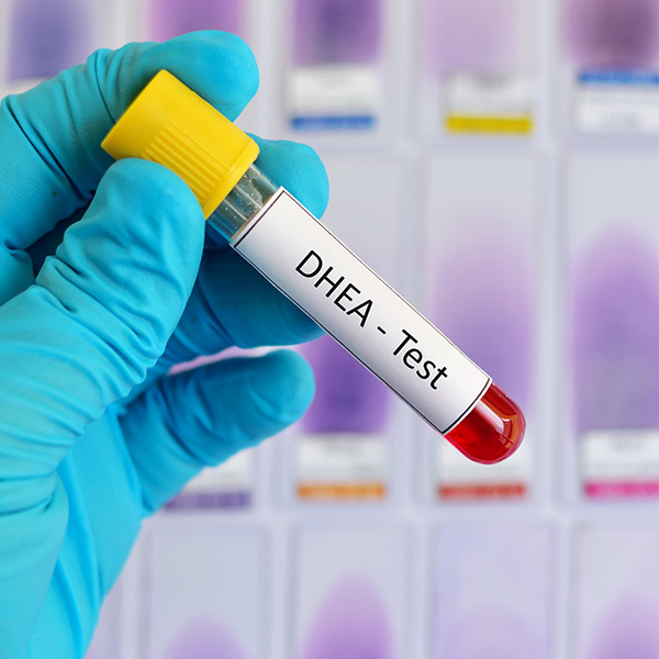 DEHIDROEPIANDROSTERONA SULFATO (DHEA SO4) DEHIDROEPIANDROSTERONA SULFATO (DHEA SO4)