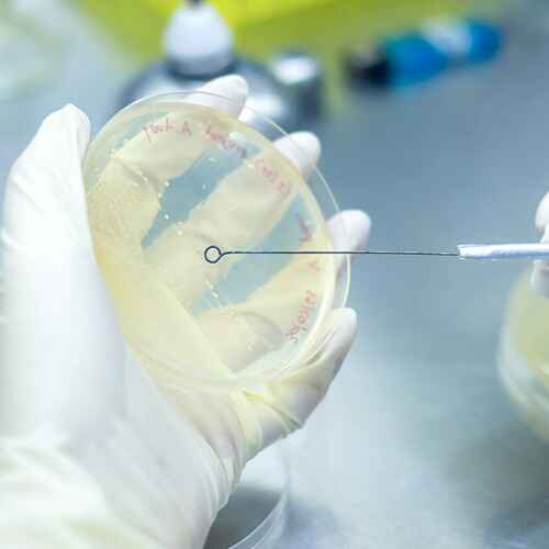 BÚSQUEDA DE TRICHOMONAS VAGINALIS BÚSQUEDA DE TRICHOMONAS VAGINALIS