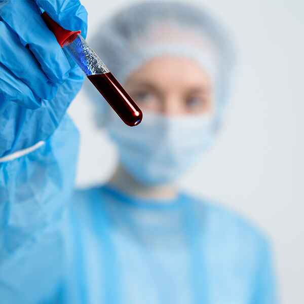 AC. ANTI EPSTEIN BARR AG NUCLEARES (EBNA IGG)