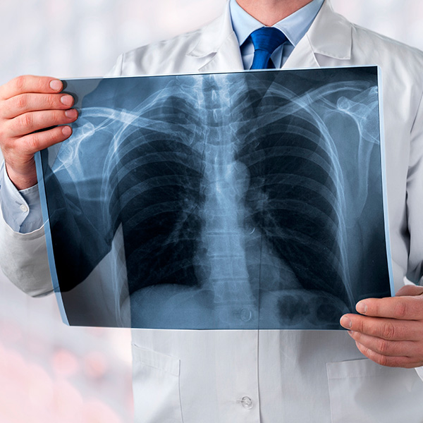 RX SERIE OSEA METASTÁSICA