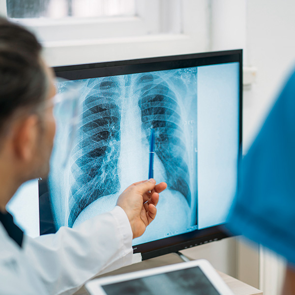 RX TELERRADIOGRAFIA DE TORAX PA, TELE TORAX