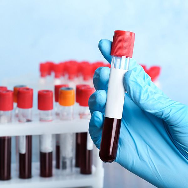 AC. ANTI CHLAMYDIA IGM E IGA AC. ANTI CHLAMYDIA IGM E IGA