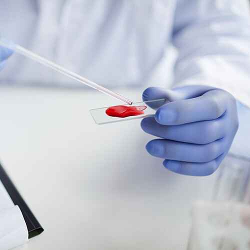 HEMOSIDERINA