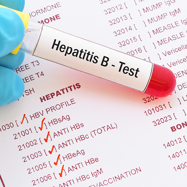 ANTIGENO s VIRUS HEPTATITIS B (HBsAg), ANTIGENO AUSTRALIA ANTIGENO s VIRUS HEPTATITIS B (HBsAg), ANTIGENO AUSTRALIA
