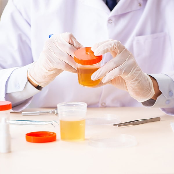 UROCULTIVO UROCULTIVO