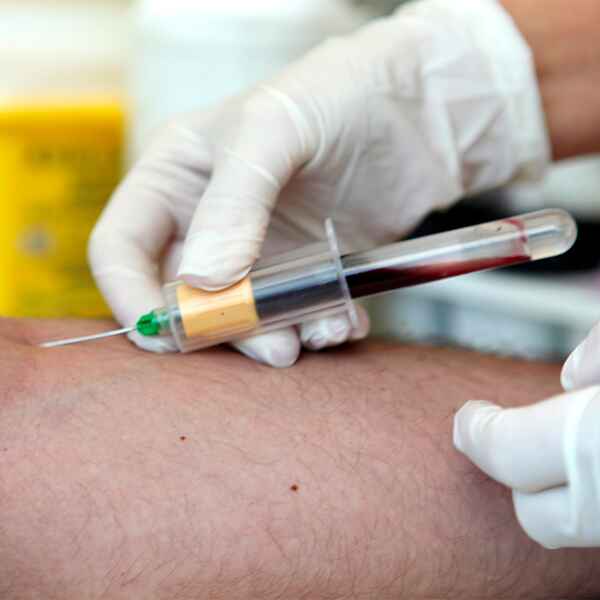 PERFIL HEPATITIS AUTOINMUNE IgG (M2, LKM1, LC1, SLA, Sp100, gp210, ACTINA) PERFIL HEPATITIS AUTOINMUNE IgG (M2, LKM1, LC1, SLA, Sp100, gp210, ACTINA)